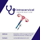 Intracervical Insemination